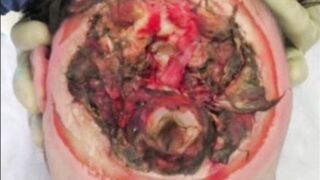 Random Gore Pictures Compilation Part 1
