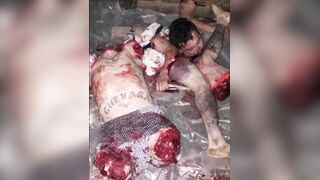 Random Gore Pictures Compilation Part 1