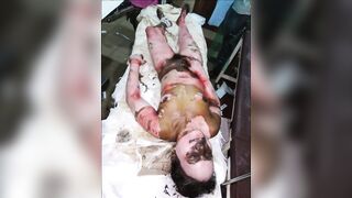 Random Gore Pictures Compilation Part 1