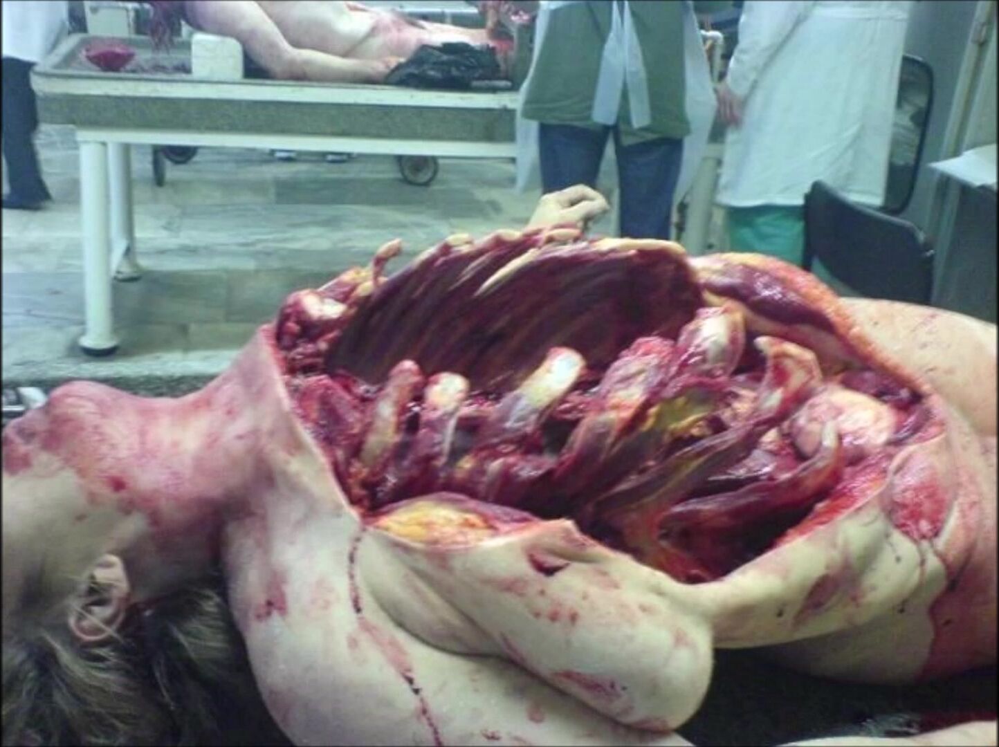 Random Gore Pictures Compilation Part 1