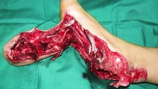 Random Gore Pictures Compilation Part 2