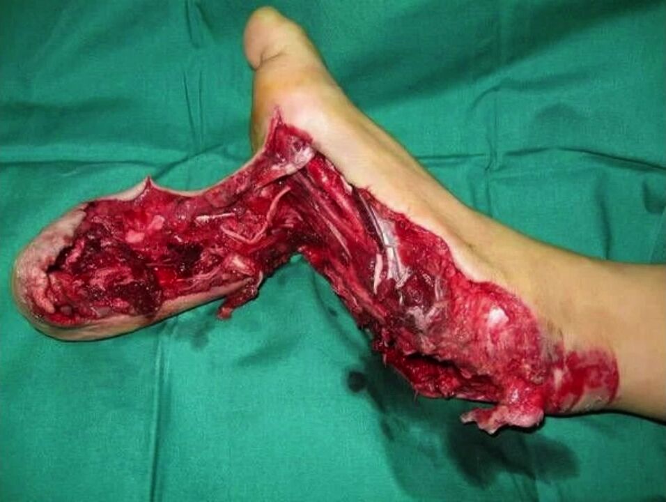 Random Gore Pictures Compilation Part 2