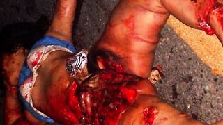 Random Gore Pictures Compilation Part 3