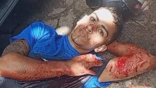 Bad Luck Criminal Vomits After Being Shot And Wounded