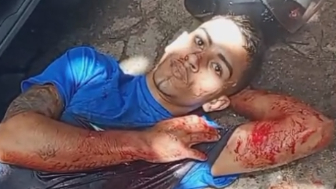 Bad Luck Criminal Vomits After Being Shot And Wounded