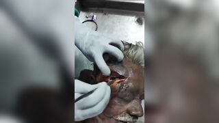 Indian old man autopsy