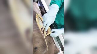 Indian old man autopsy