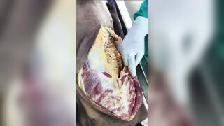 Indian old man autopsy