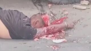 I Doubt Helmet Could Save Him