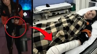 Twitch streamer "Bisscute" cut her tendons on two fingers
