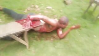 Black Man In Africa Getting His Arm Cut Off- [Old YNC video]