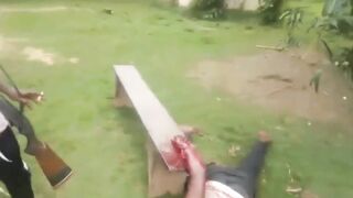 Black Man In Africa Getting His Arm Cut Off- [Old YNC video]