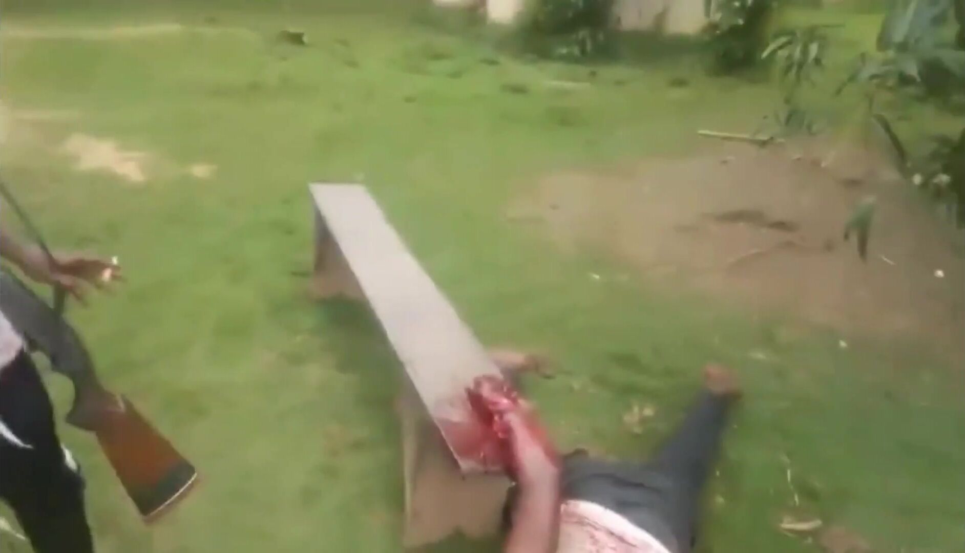 Black Man In Africa Getting His Arm Cut Off- [Old YNC video]