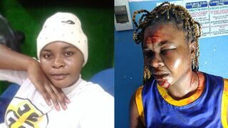 Domestic Violence: Woman Bleeds After Being Beaten And Stabbed By Evil Husband