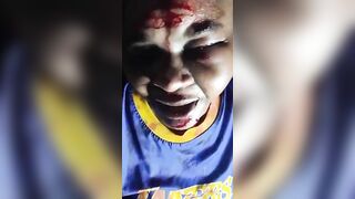 Domestic Violence: Woman Bleeds After Being Beaten And Stabbed By Evil Husband