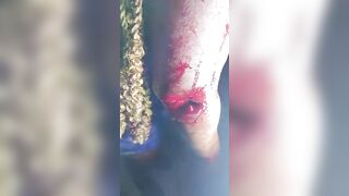 Domestic Violence: Woman Bleeds After Being Beaten And Stabbed By Evil Husband