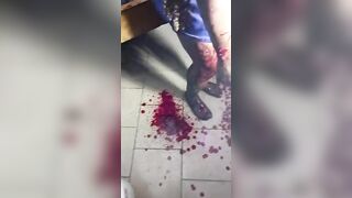 Domestic Violence: Woman Bleeds After Being Beaten And Stabbed By Evil Husband