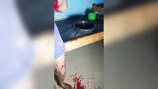 Domestic Violence: Woman Bleeds After Being Beaten And Stabbed By Evil Husband