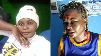 Domestic Violence: Woman Bleeds After Being Beaten And Stabbed By Evil Husband