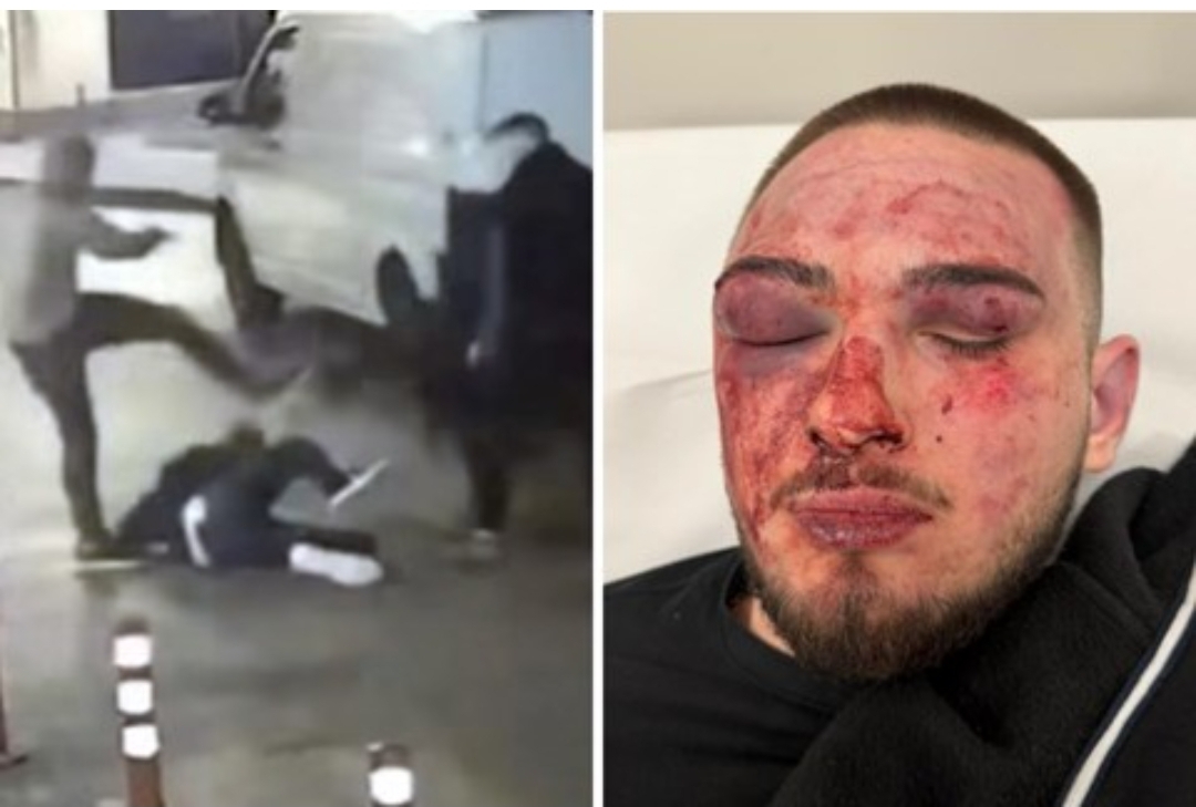 Brutal beating