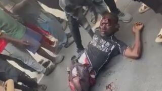 TERRRIBLE: Fully Awake Man Suffers Nasty Injuries Following Truck Accident In Africa