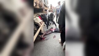 TERRRIBLE: Fully Awake Man Suffers Nasty Injuries Following Truck Accident In Africa