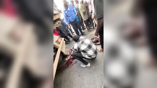 TERRRIBLE: Fully Awake Man Suffers Nasty Injuries Following Truck Accident In Africa