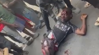 TERRRIBLE: Fully Awake Man Suffers Nasty Injuries Following Truck Accident In Africa