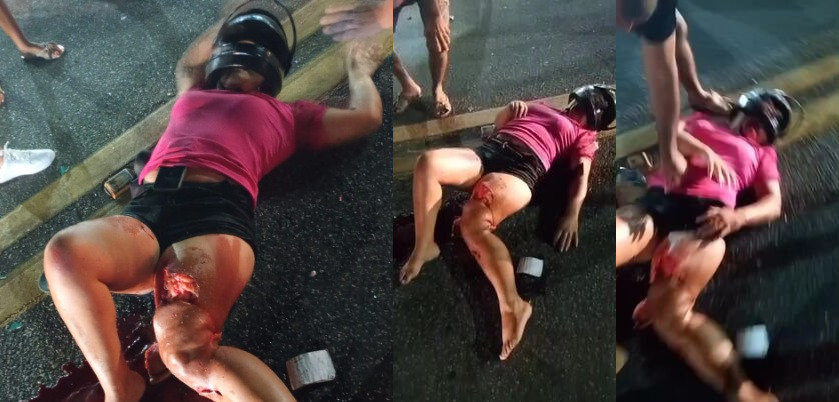 Woman terribly Injured in Accident