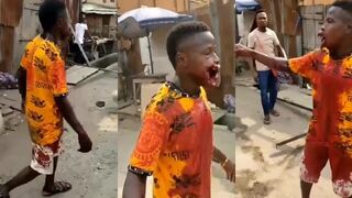 Dude Shot In His Mouth During Protest