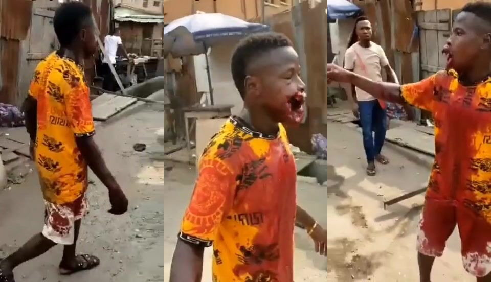 Dude Shot In His Mouth During Protest