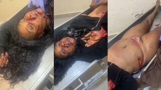 Haitian Woman Hacked To Death With Machete In Dominican Republic