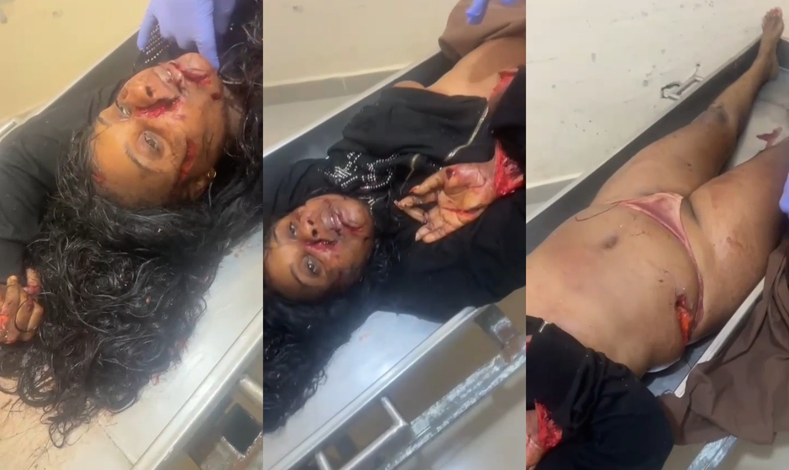 Haitian Woman Hacked To Death With Machete In Dominican Republic