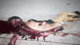 Man Dragged For Around 200 Meters In Maracaibo After Being Hit by A Car