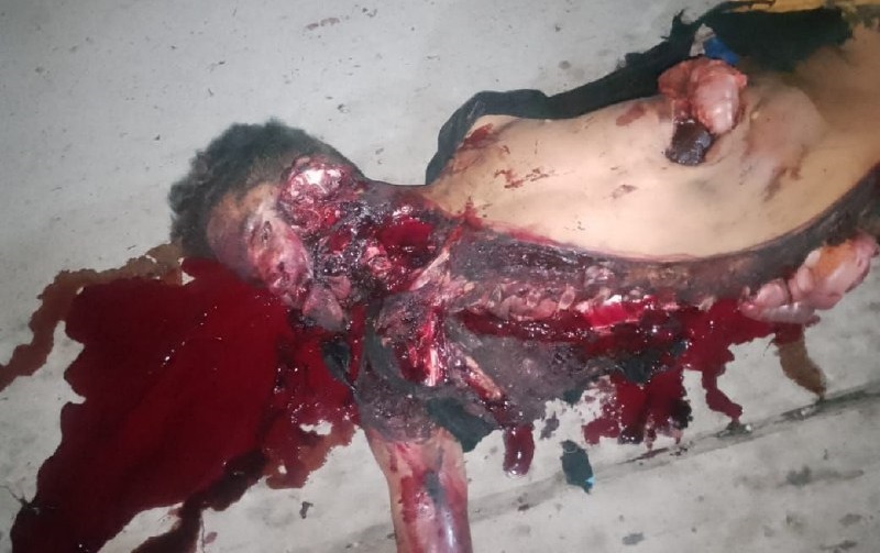 Man Dragged For Around 200 Meters In Maracaibo After Being Hit by A Car