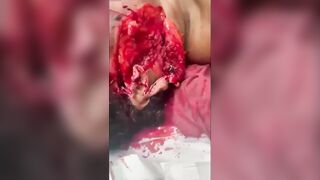 Woman Brutally Hacked to Death With Machete In Jamaica