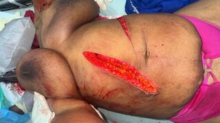 Girlfriend Brutally Hacked With Machete After Ending Relationship