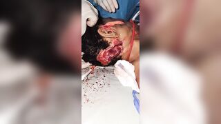 Woman Brutally Hacked to Death With Machete In Jamaica