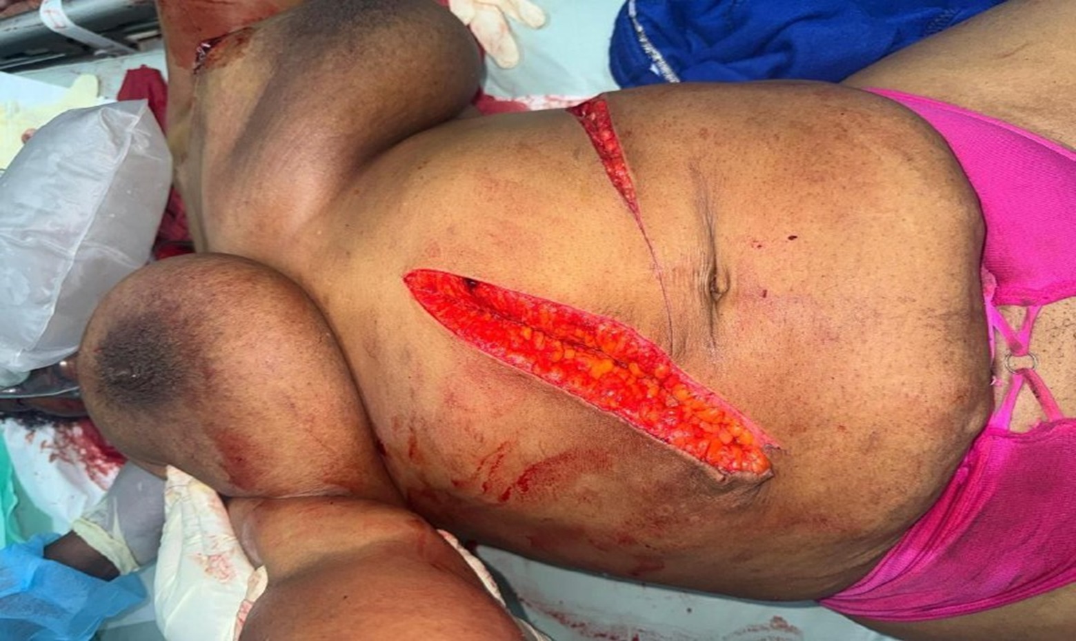 Woman Brutally Hacked to Death With Machete In Jamaica