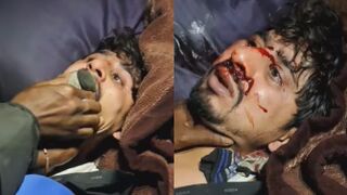 Kidnapped Man Tortured And Humiliated By Gang For Ransom