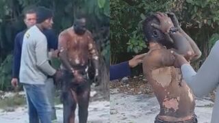 Driver suffers third-degree burns after his bus catches fire