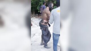 Driver suffers third-degree burns after his bus catches fire