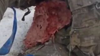 Ukrainians take headaches to another level.