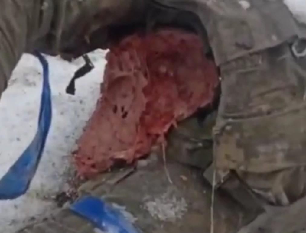 Ukrainians take headaches to another level.