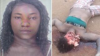 Woman's Face Severely Disfigured After Being Stoned by Boyfriend