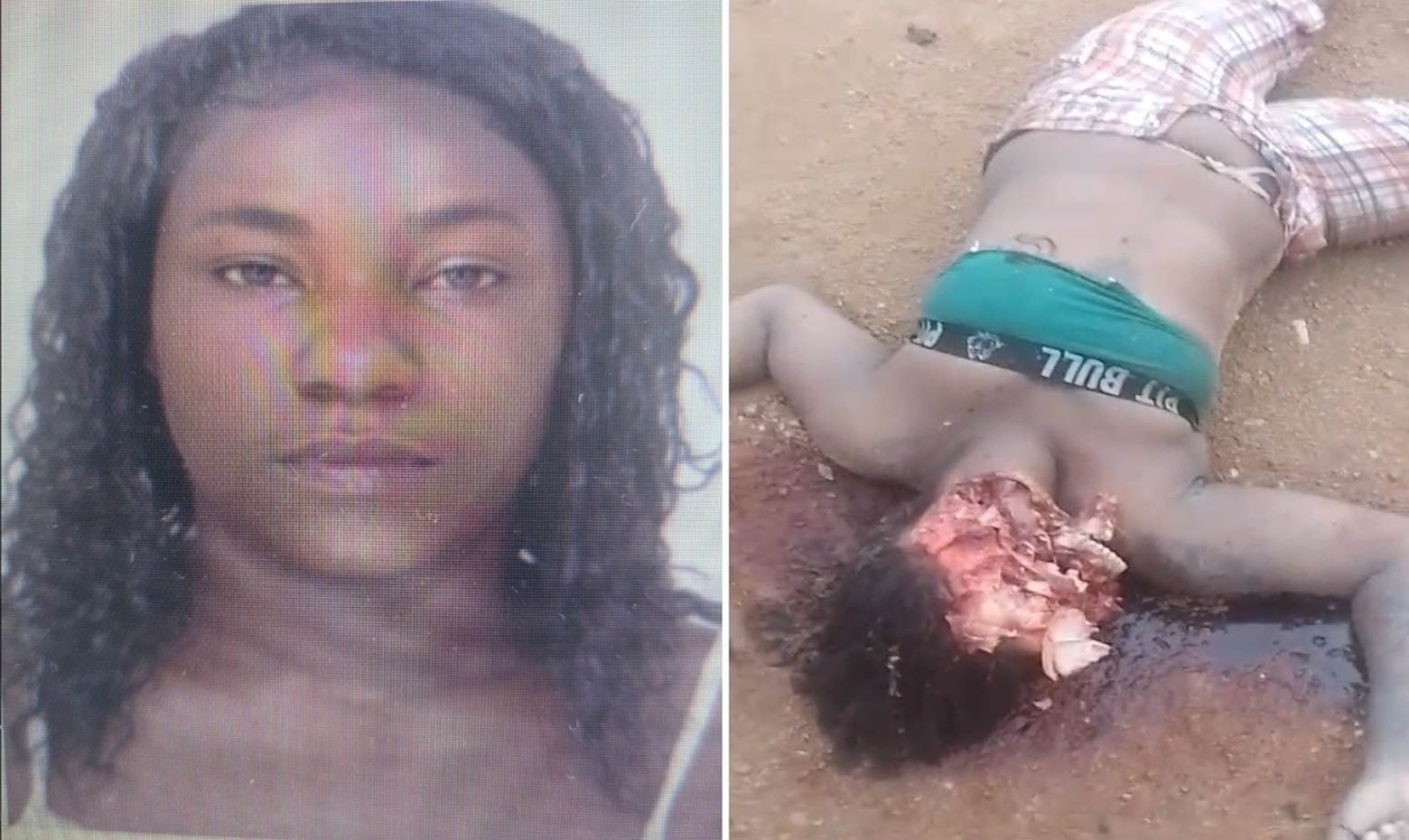 Woman's Face Severely Disfigured After Being Stoned by Boyfriend