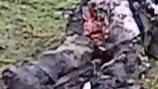 Baby's ass ruptured