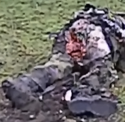 Baby's ass ruptured