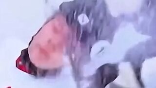 An American woman cut a Polish athlete's face with a skate blade