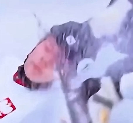 An American woman cut a Polish athlete's face with a skate blade
